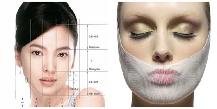 Phẫu thuật độn cằm ở Hà Nội