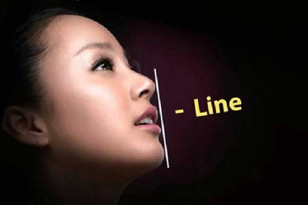 Độn cằm i line