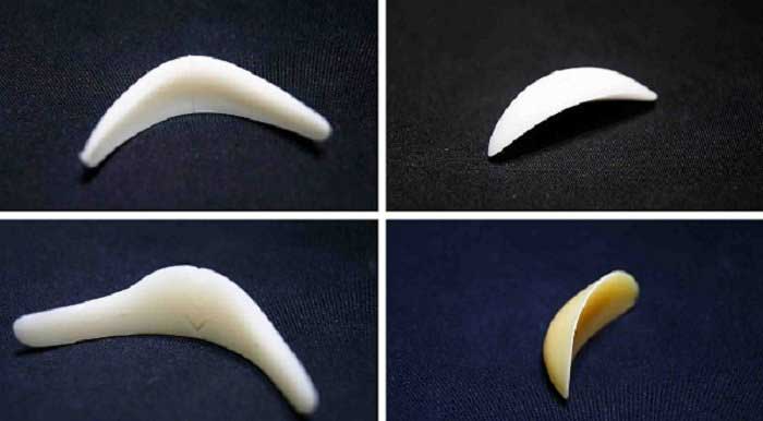 Độn cằm bằng silicon