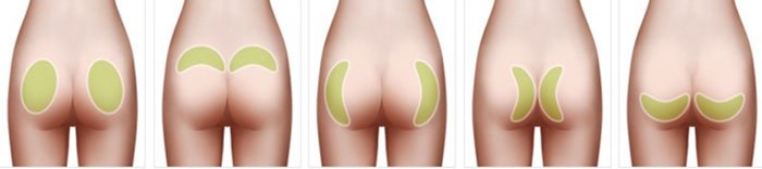 Quần độn mông mua ở đâu