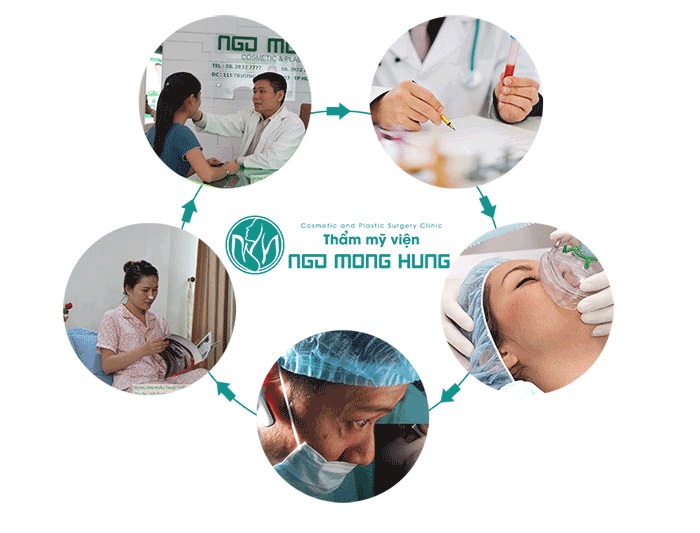 Hạ gò má ở đâu đẹp