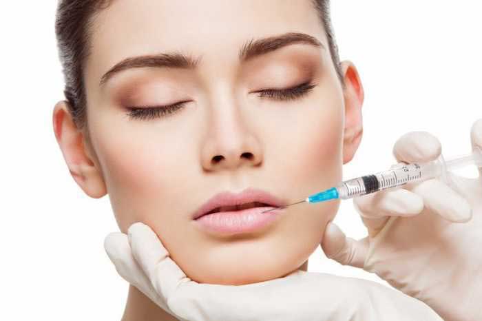 Chữa cười hở lợi bằng mắc cài tự tiêu Chữa cười hở lợi bằng mắc cài tự tiêu