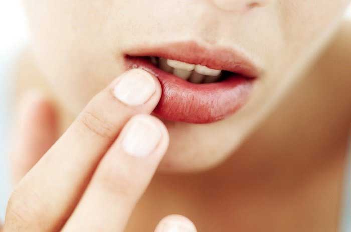 Phẫu thuật môi bị hỏng