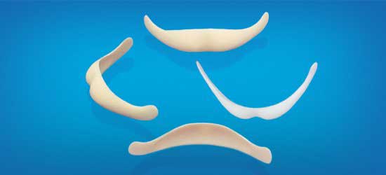Độn cằm V line giá bao nhiêu