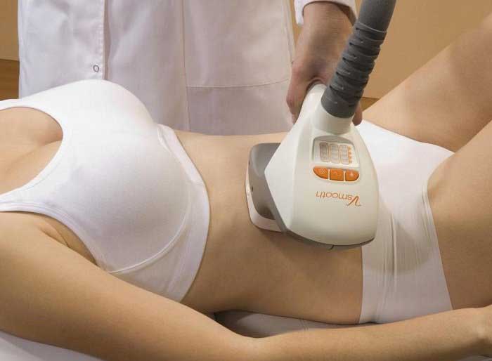 Hút mỡ bụng bằng Laser Lipo