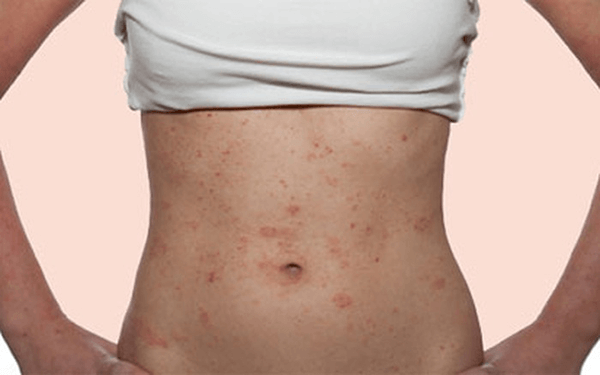 Dây nịt nâng mông