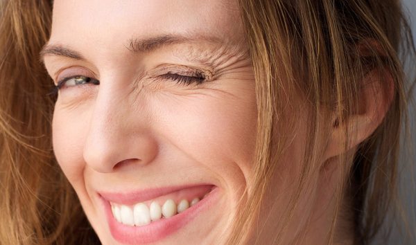 Xóa nếp nhăn trên khóe miệng