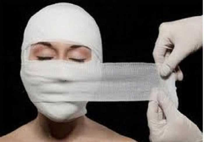 Gọt cằm và biến chứng