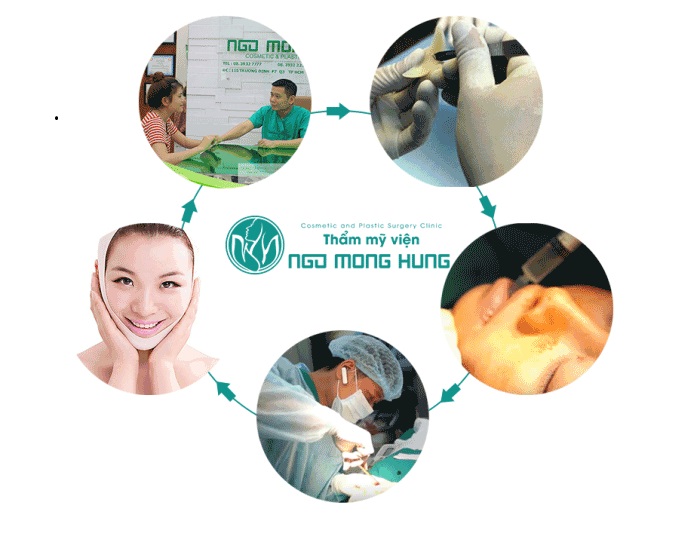 Phẫu thuật thay đổi khuôn mặt
