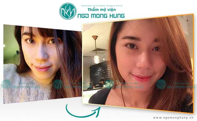 Thu mỏng môi ở đâu đẹp
