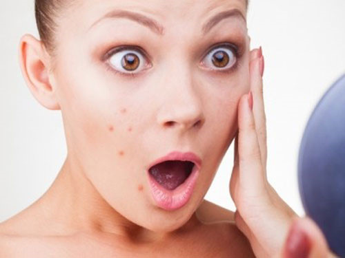 Kem xóa nếp nhăn ở mắt