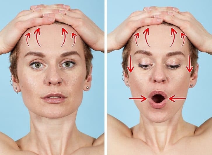 Xóa nếp nhăn trên khóe miệng