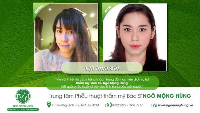 Thu mỏng môi