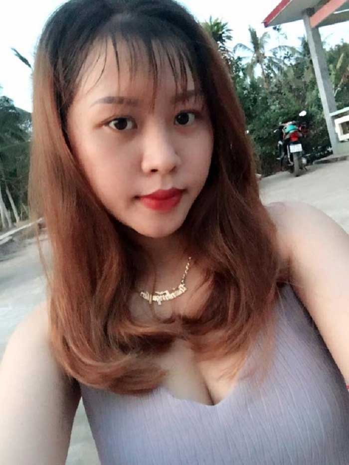 Nâng mũi bọc sụn