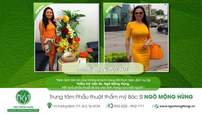 Nâng ngực nội soi