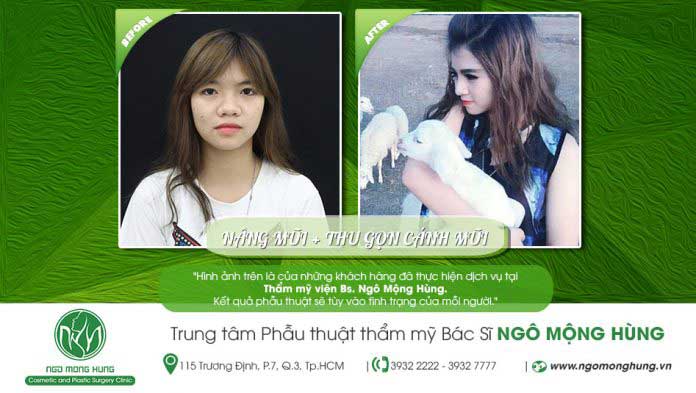 Thu gọn cánh mũi