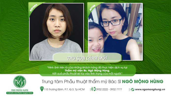 Thu gọn cánh mũi