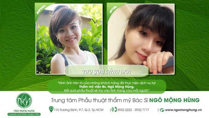 Thu gọn cánh mũi