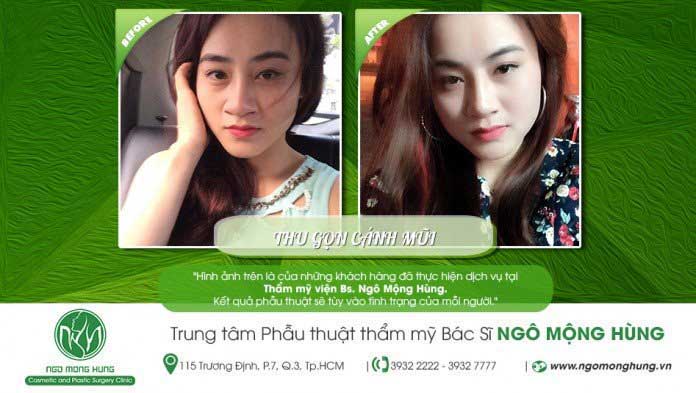 Thu gọn cánh mũi