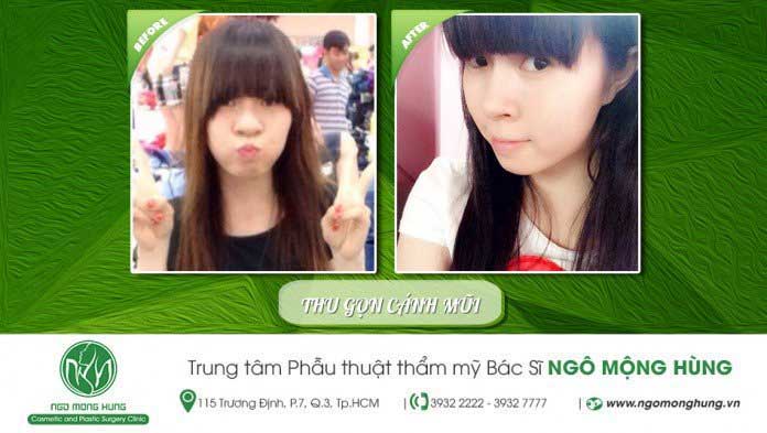 Thu gọn cánh mũi