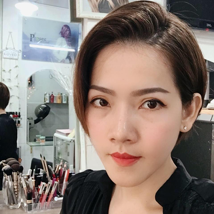 Cắt mí mắt