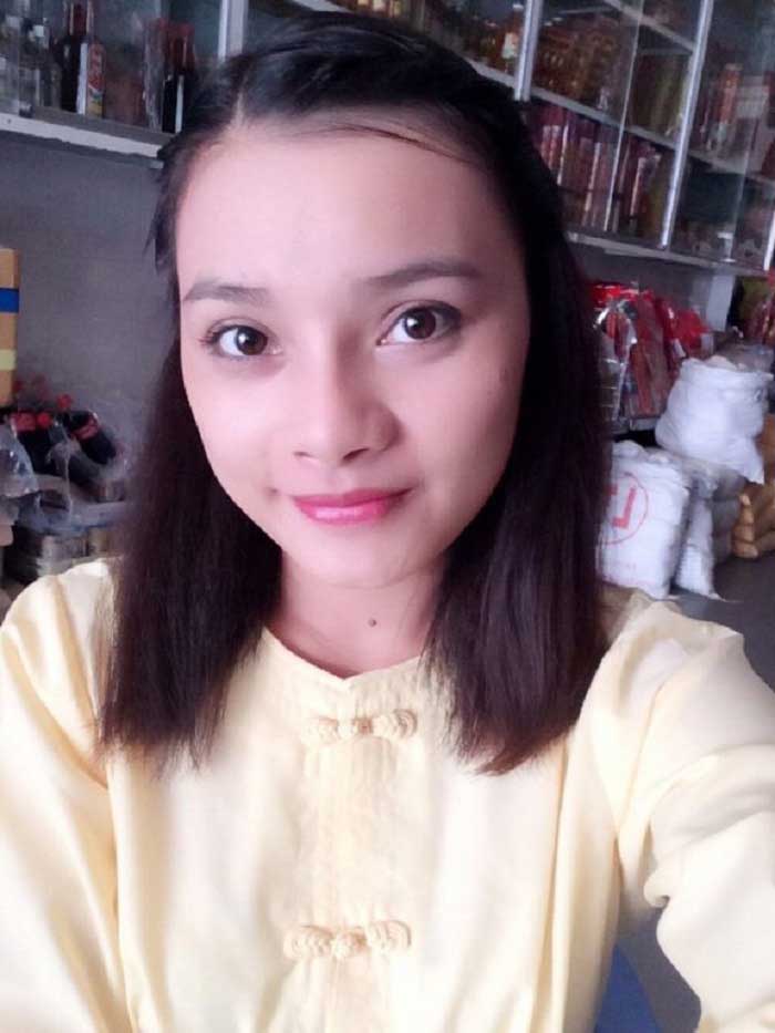 Nâng mũi bọc sụn