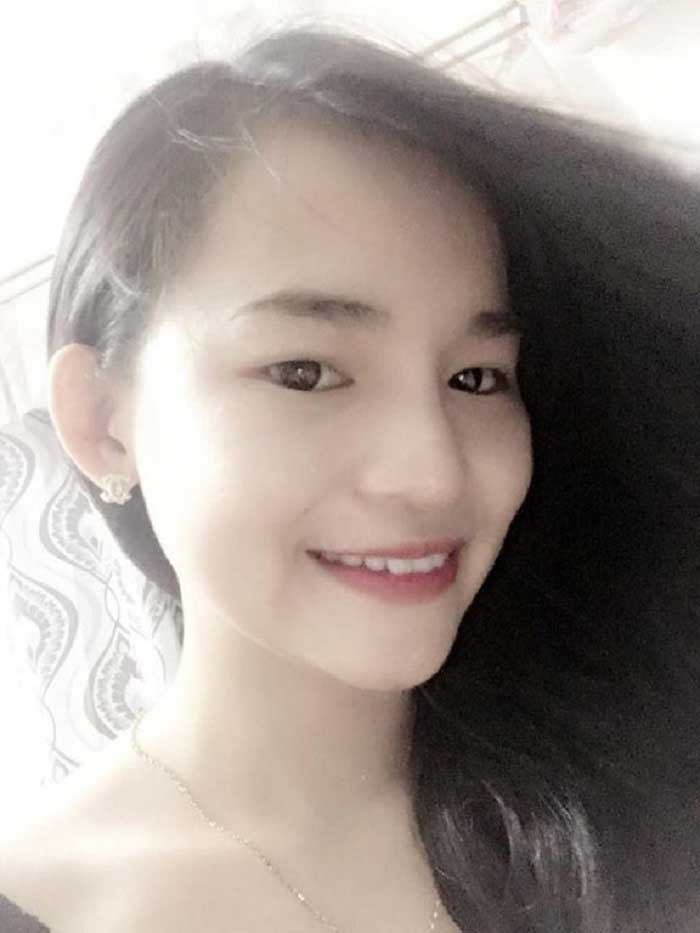 Nâng mũi bọc sụn