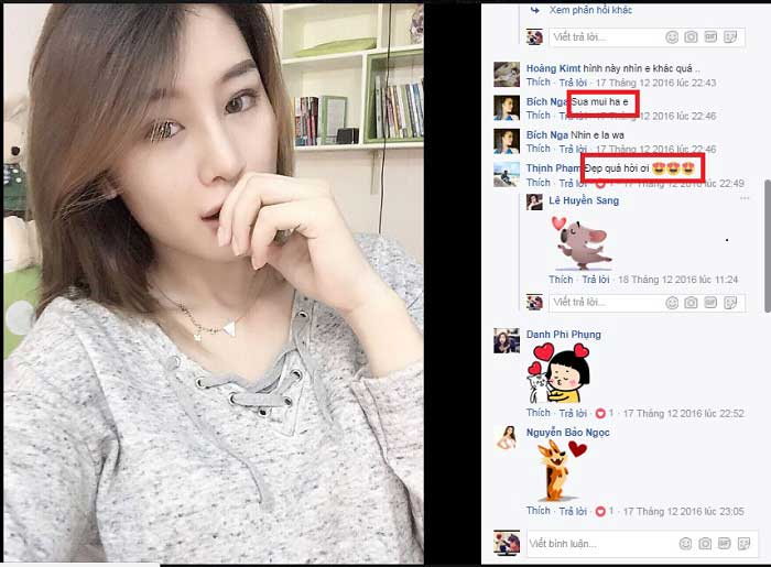 Nâng mũi S Line Nâng mũi S Line