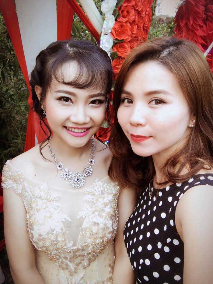 Cắt mí mắt