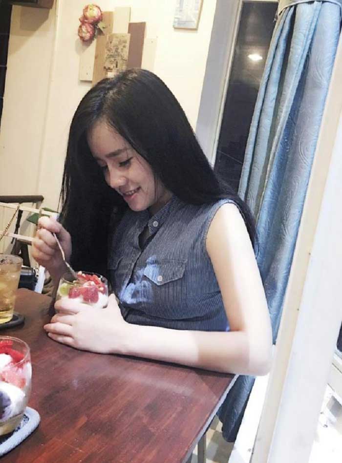 Nâng mũi bọc sụn