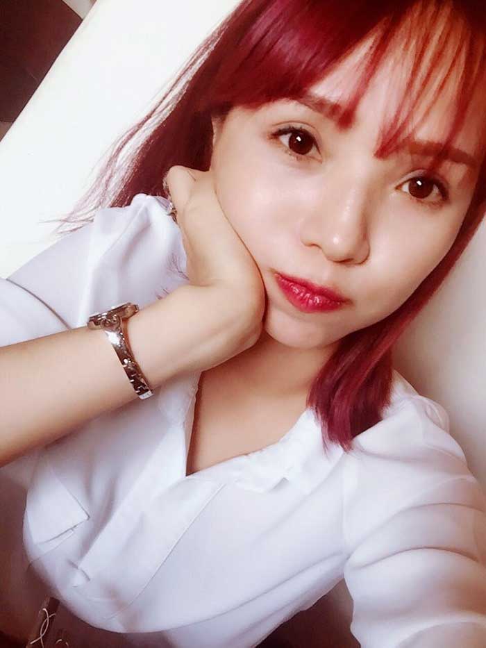 Cắt mí mắt