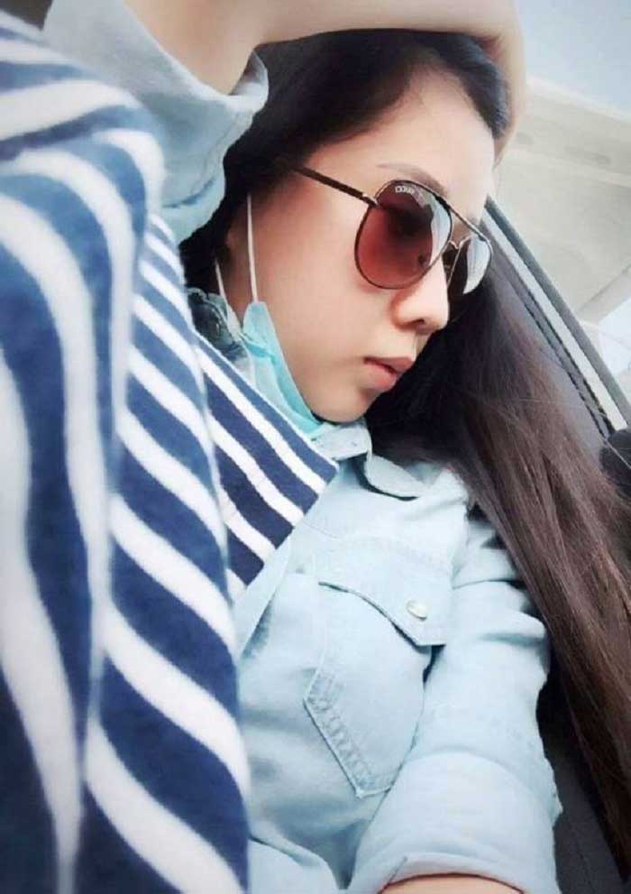 Nâng mũi bọc sụn