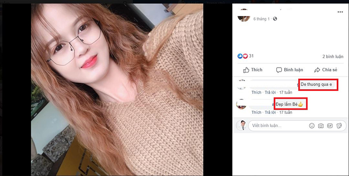 Nâng mũi bọc sụn