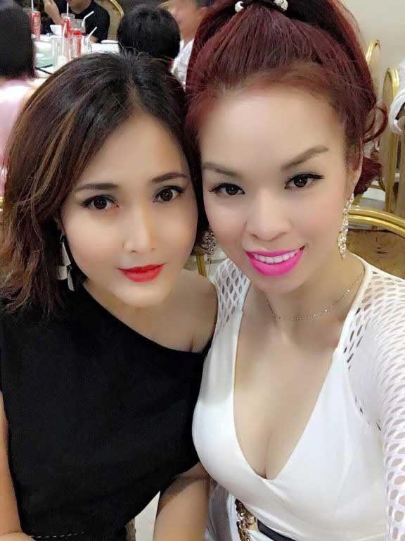 Căng da mặt Căng da mặt
