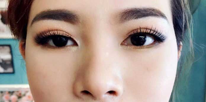 Bấm mí Hàn Quốc