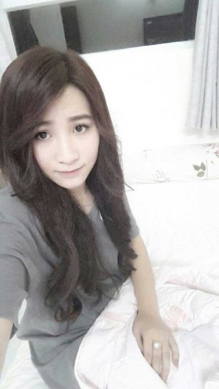 Nâng mũi bọc sụn