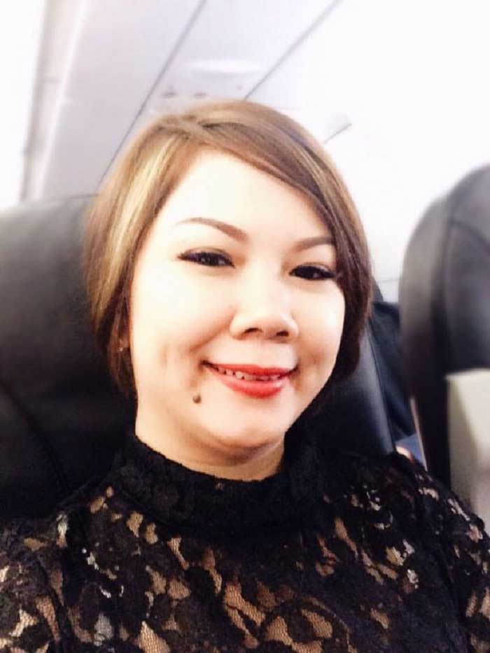 Cắt mí mắt