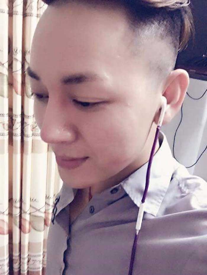 Nâng mũi bọc sụn