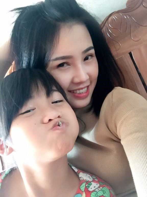 Bấm mí Hàn Quốc