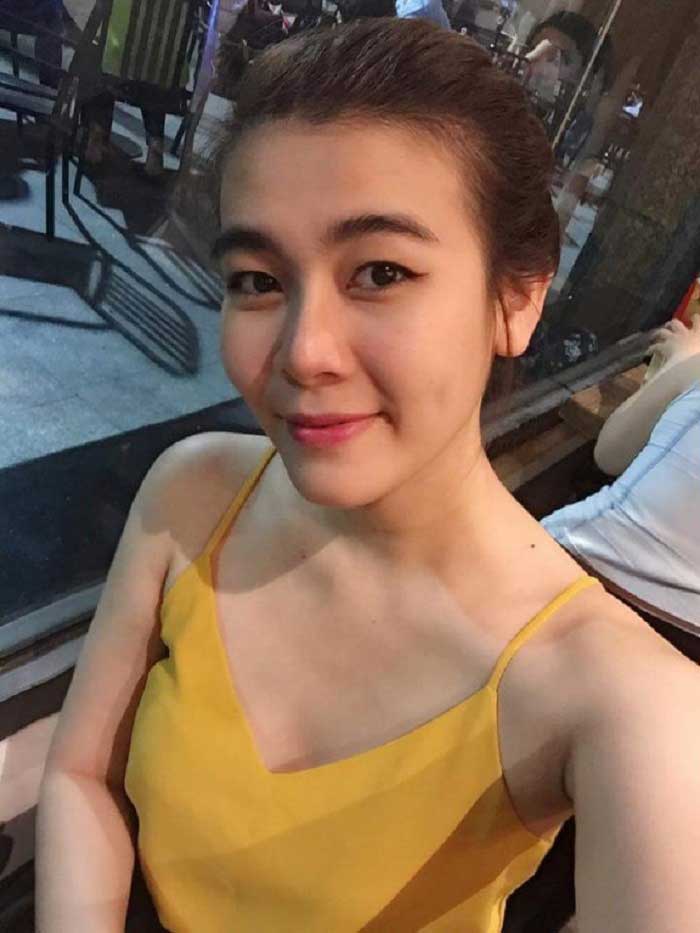 Nâng mũi Hàn Quốc