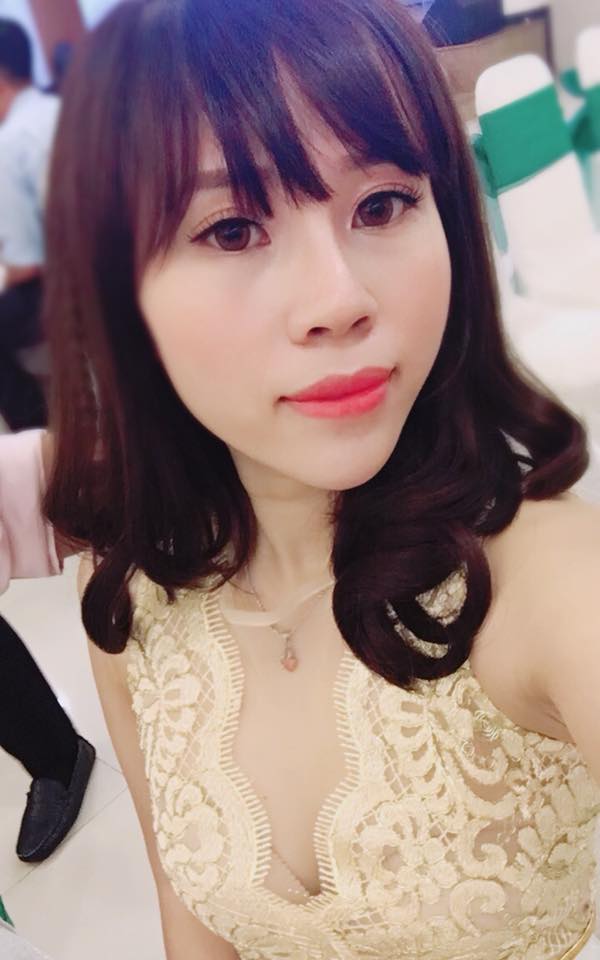 Nâng mũi bọc sụn