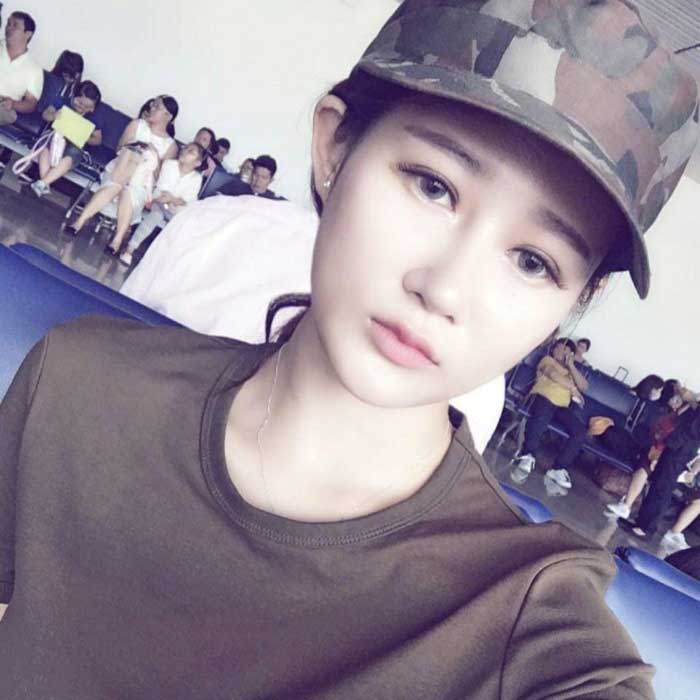 Nâng mũi Hàn Quốc