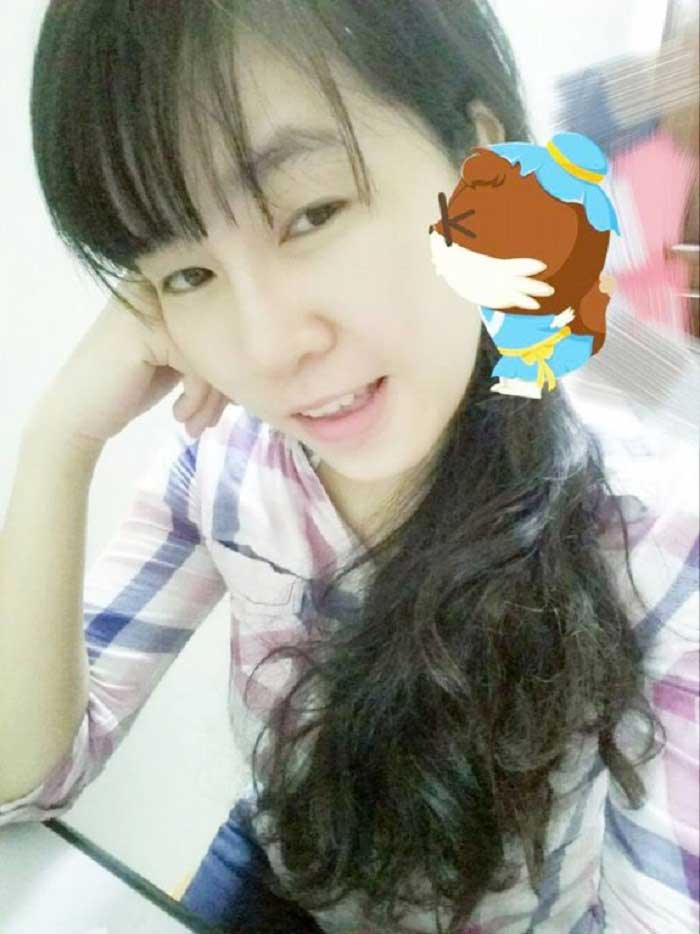 Nâng mũi bọc sụn