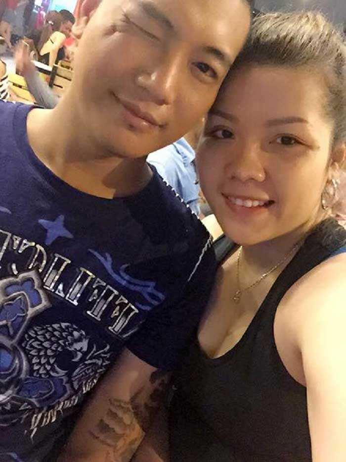 Cắt mí mắt