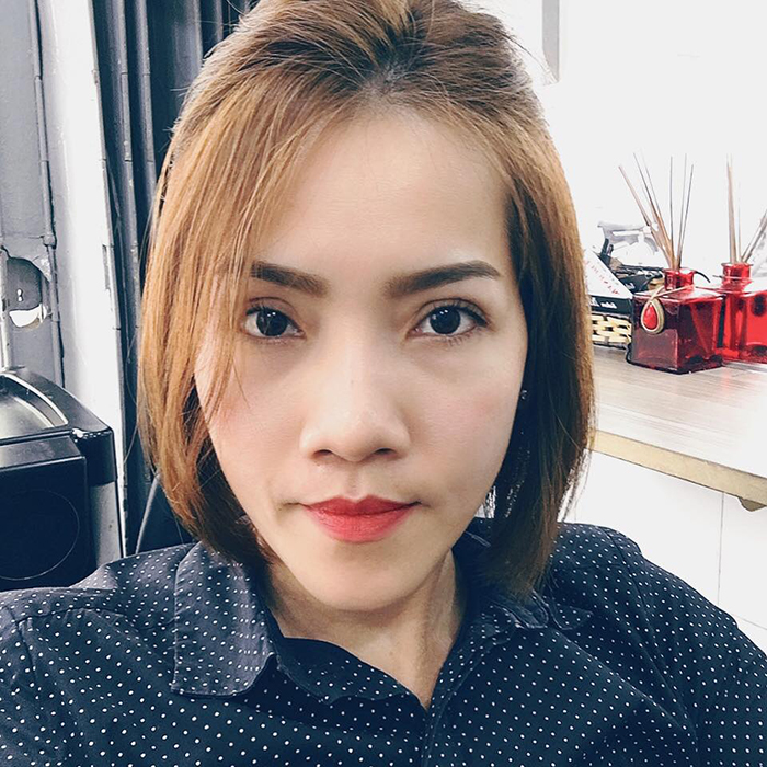 Cắt mí mắt