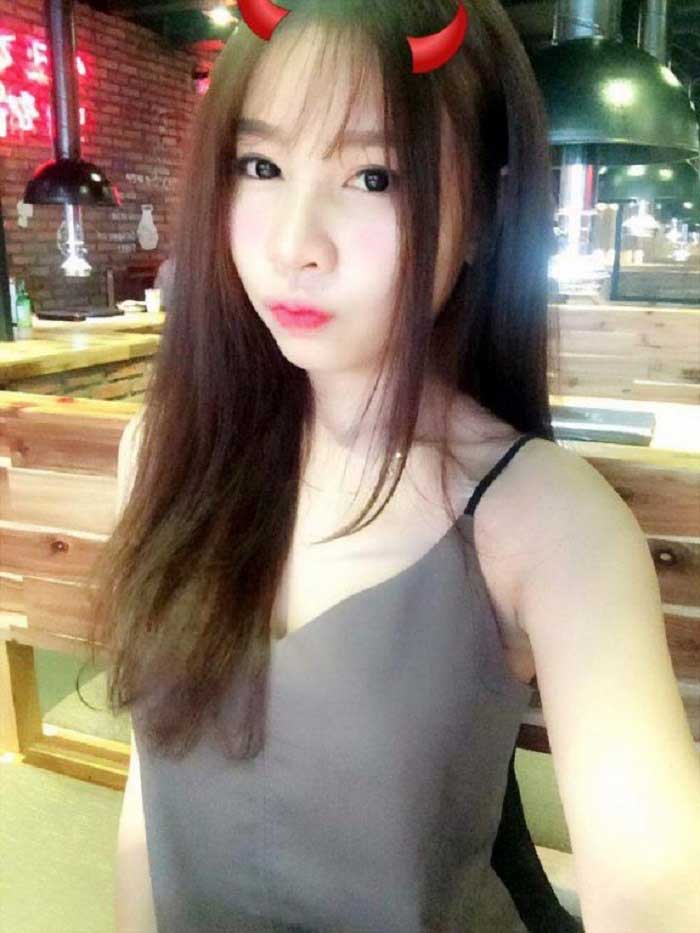 Nâng mũi bọc sụn