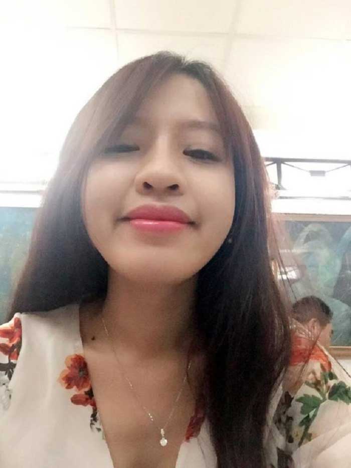 Nâng mũi bọc sụn