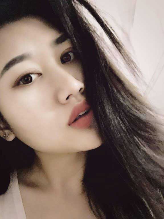 Độn cằm