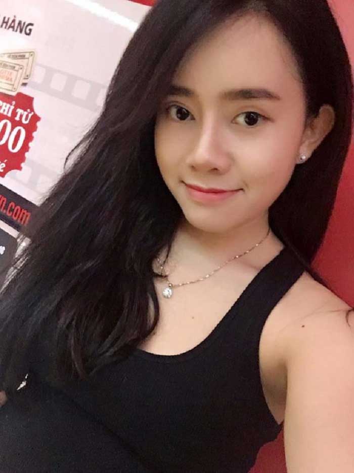 Nâng mũi bọc sụn