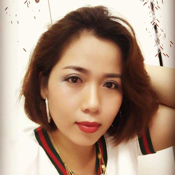 Cắt mí mắt